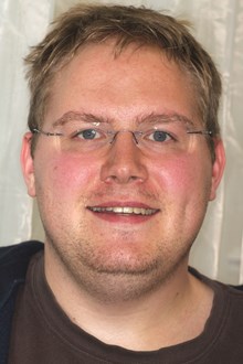 Festsitzende Zahnspange