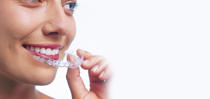 Zahnspangen Kieferorthopadie Zahnarzt Wien Invisalign